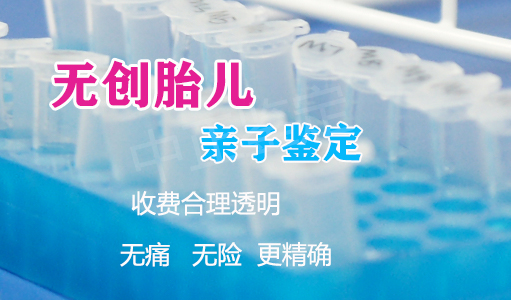 内江孕期亲子鉴定如何收费,内江怀孕亲子鉴定需要怎么做